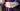 Diode Dynamics 08-14 Subaru WRX/STi Hatchback Tail as Turn +Backup Module (USDM) Stage 2